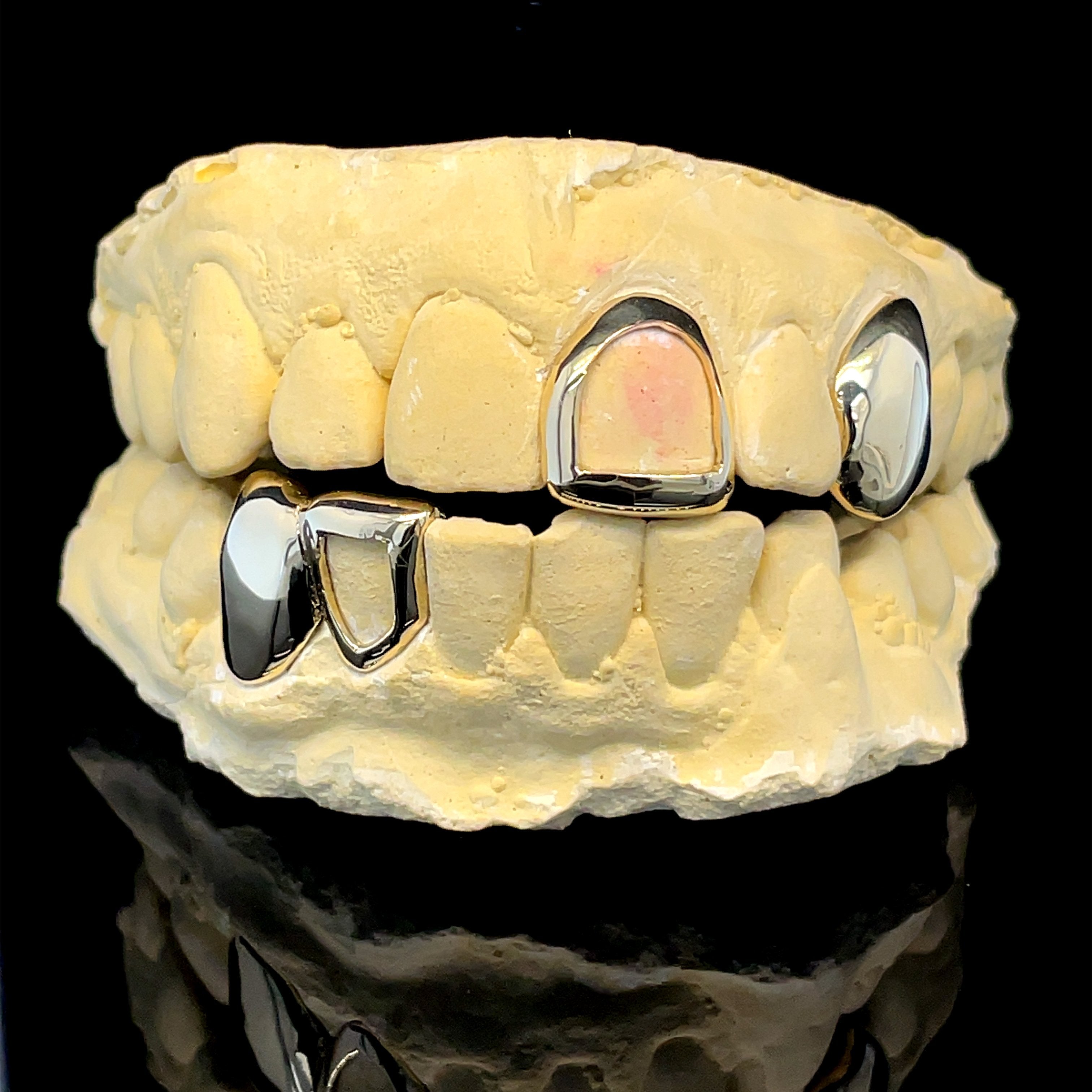 Caps and Frames Grillz Set