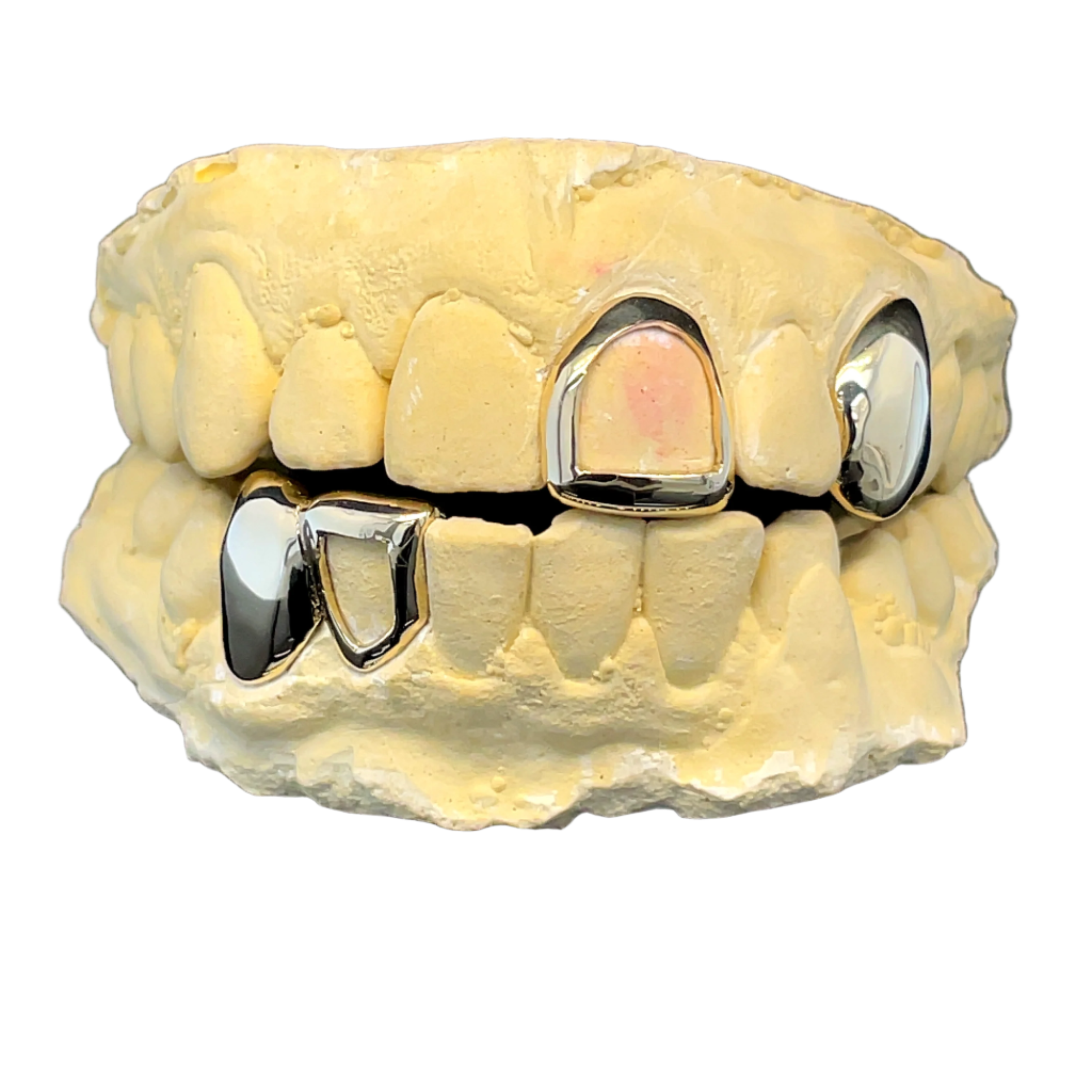 Caps and Frames Grillz Set