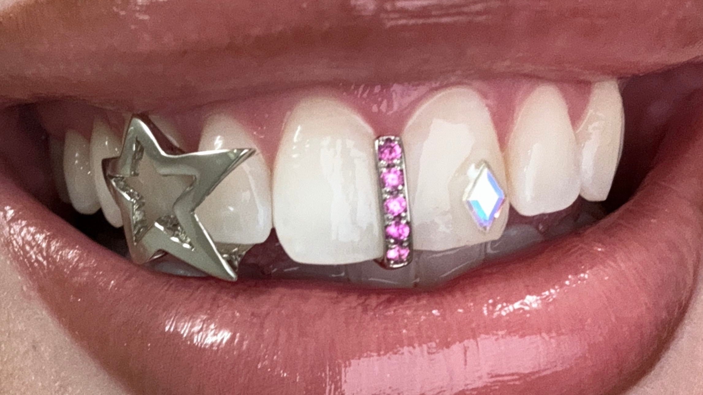 Astro Star Gem Gapfiller Grillz