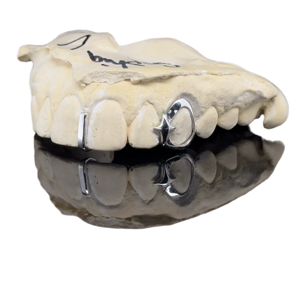 Sparkle Star Frame Gapfiller Grillz
