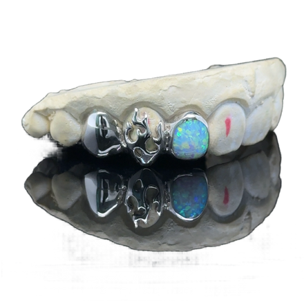 Flame Opal Cap Grillz