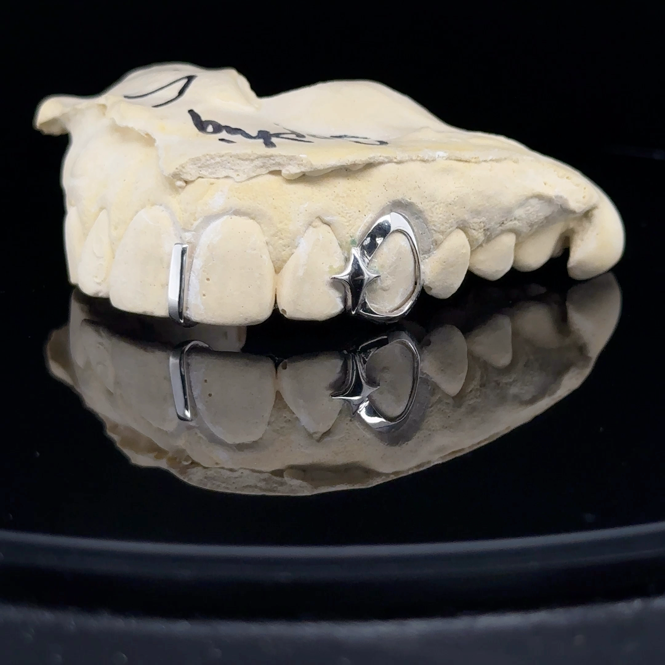 Sparkle Star Frame Gapfiller Grillz