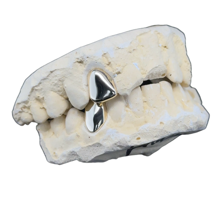 Yellow Gold Grillz