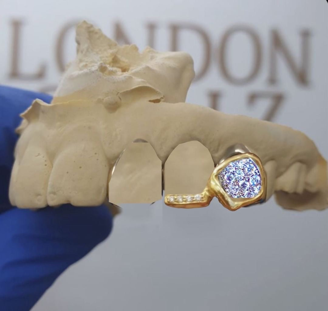 Custom 10k diamonds Grillz