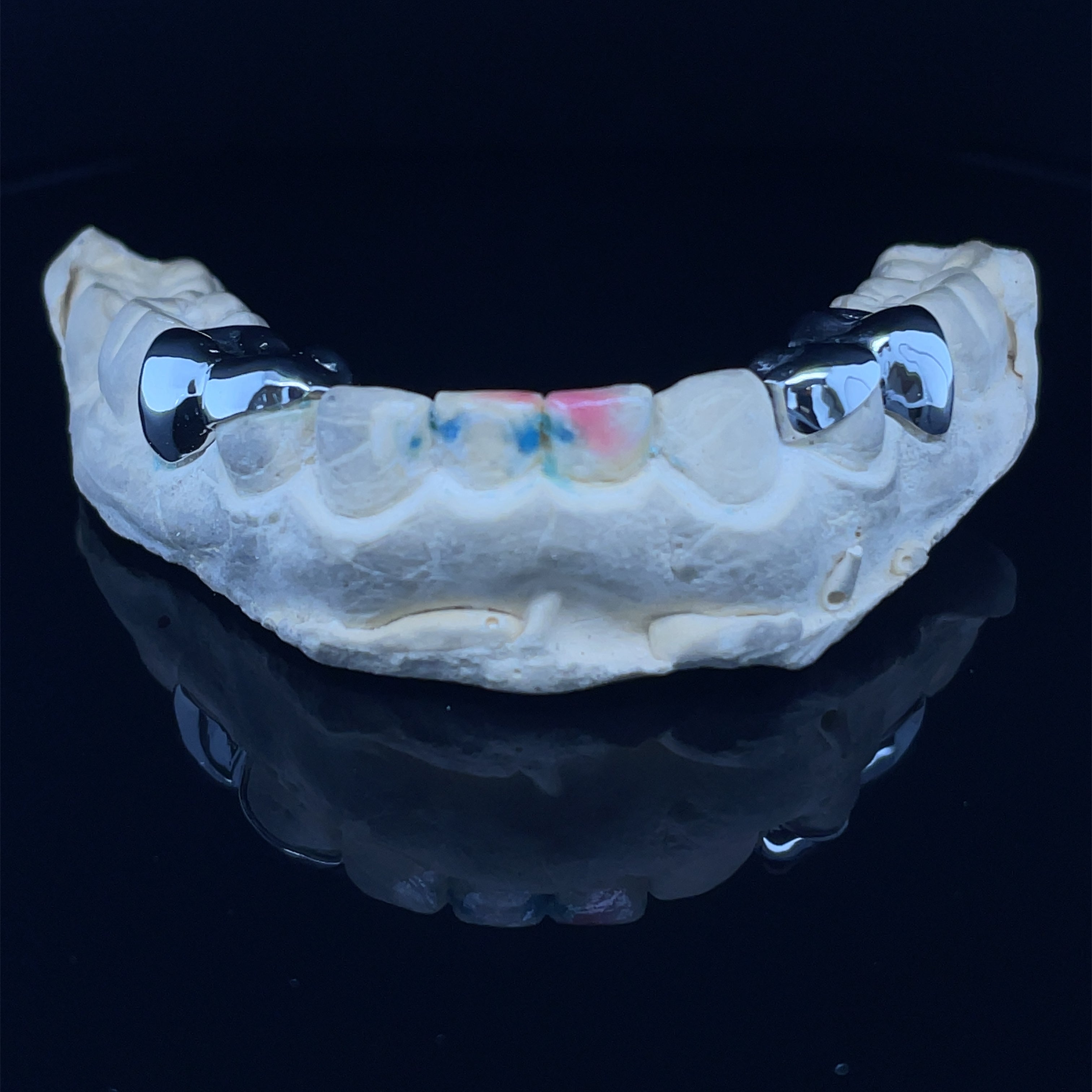 White Gold Grillz