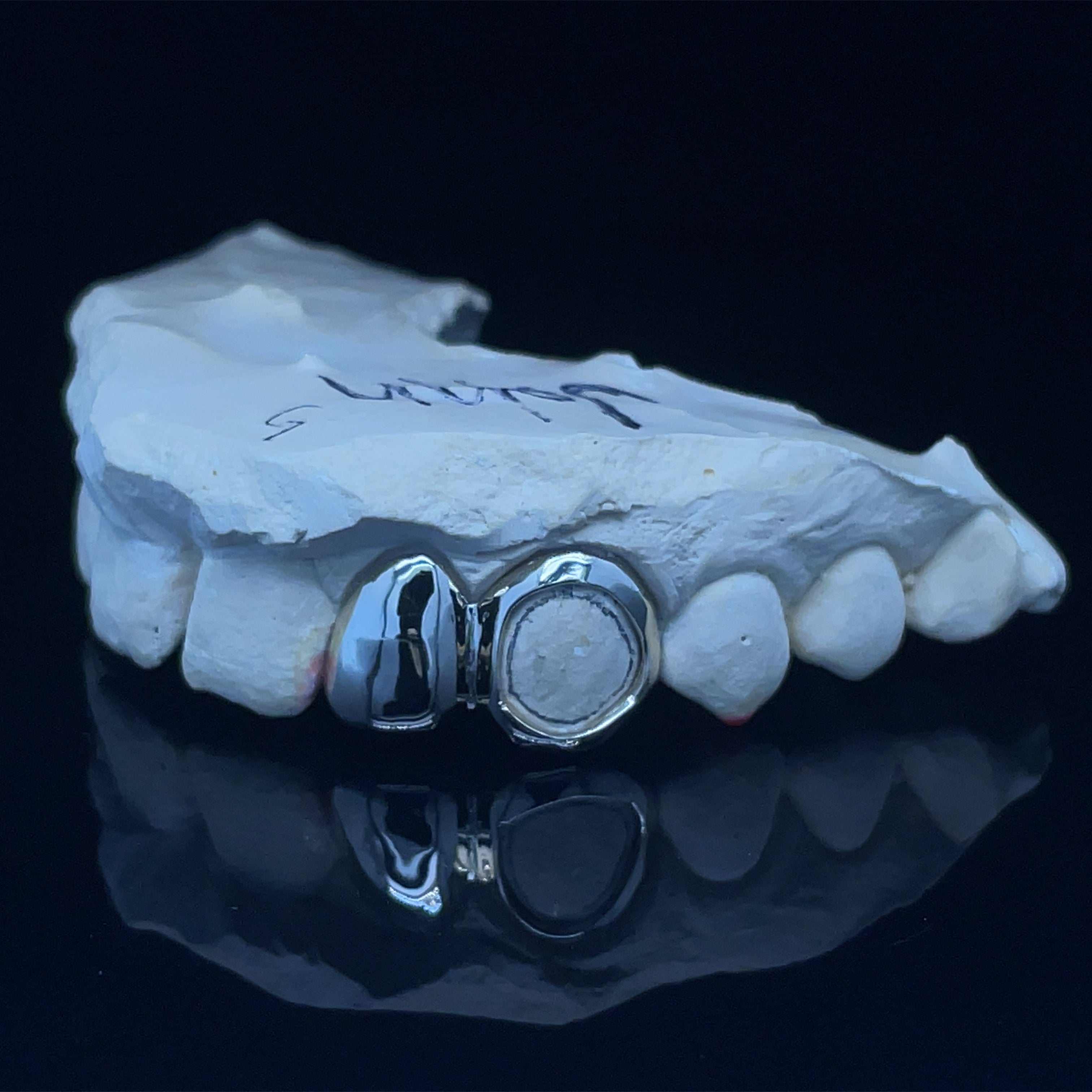 Yellow Gold Grillz