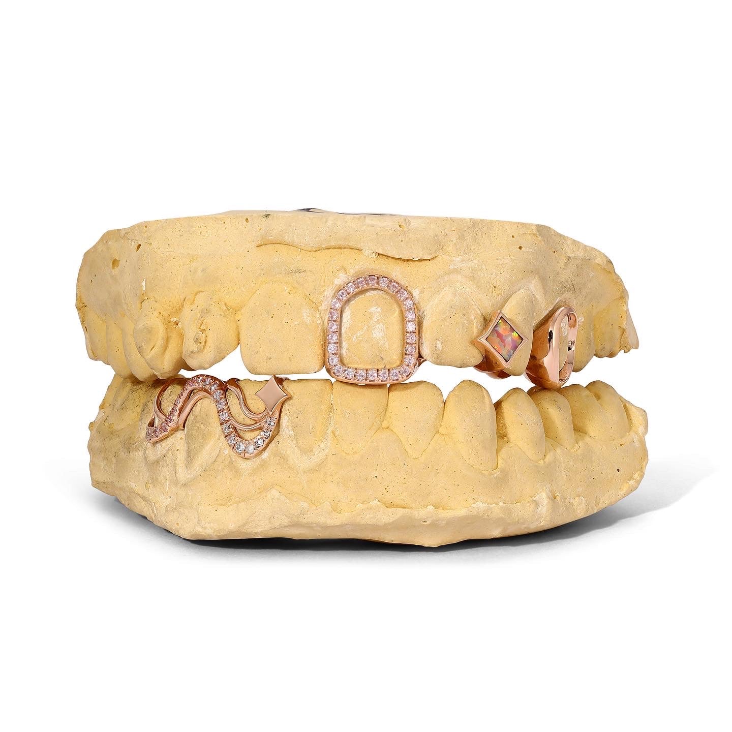 Rose Gold Grillz