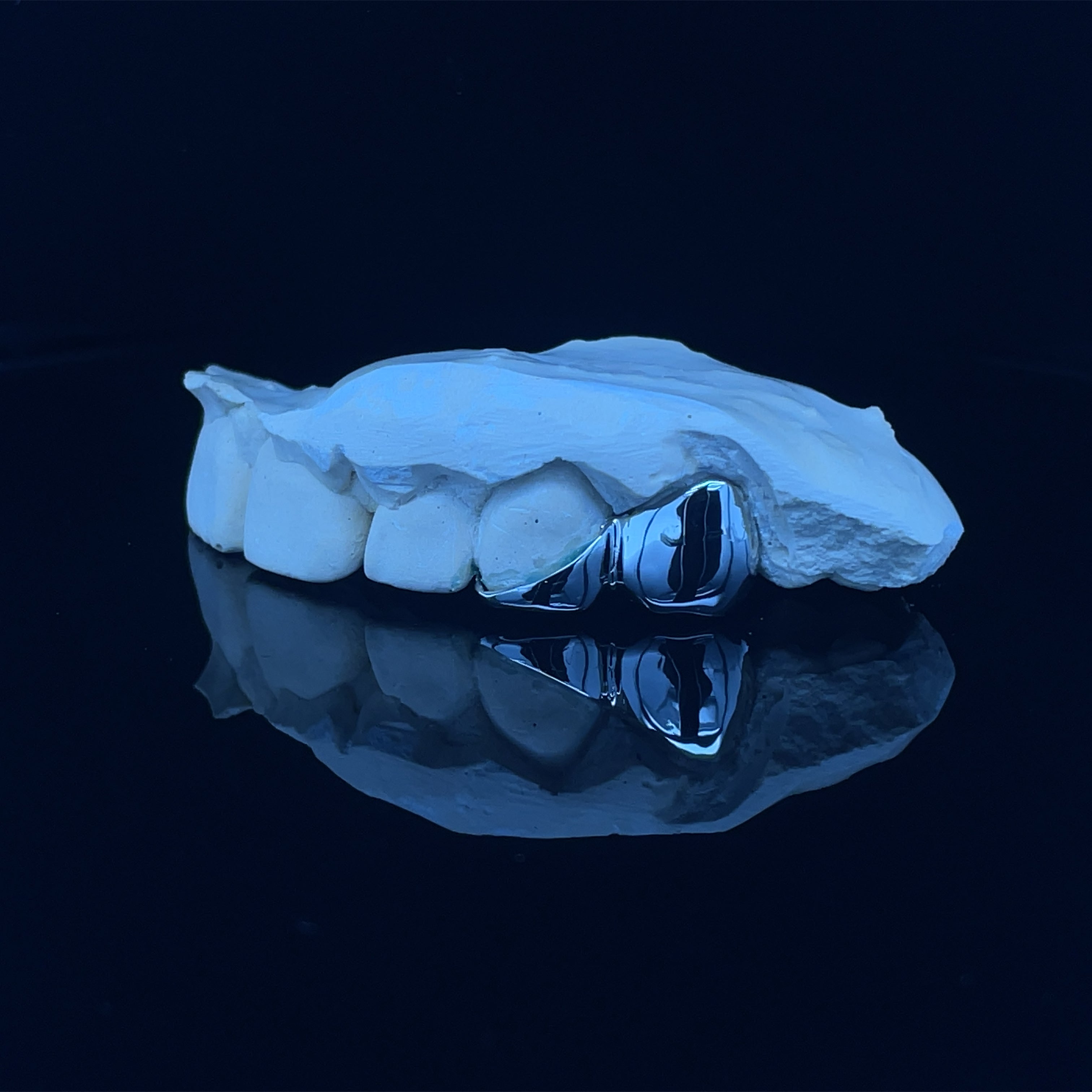 White Gold Grillz