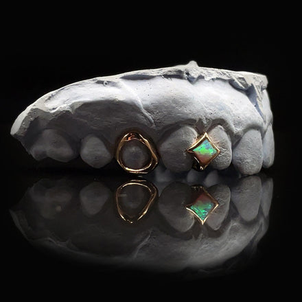 Rose Gold Grillz