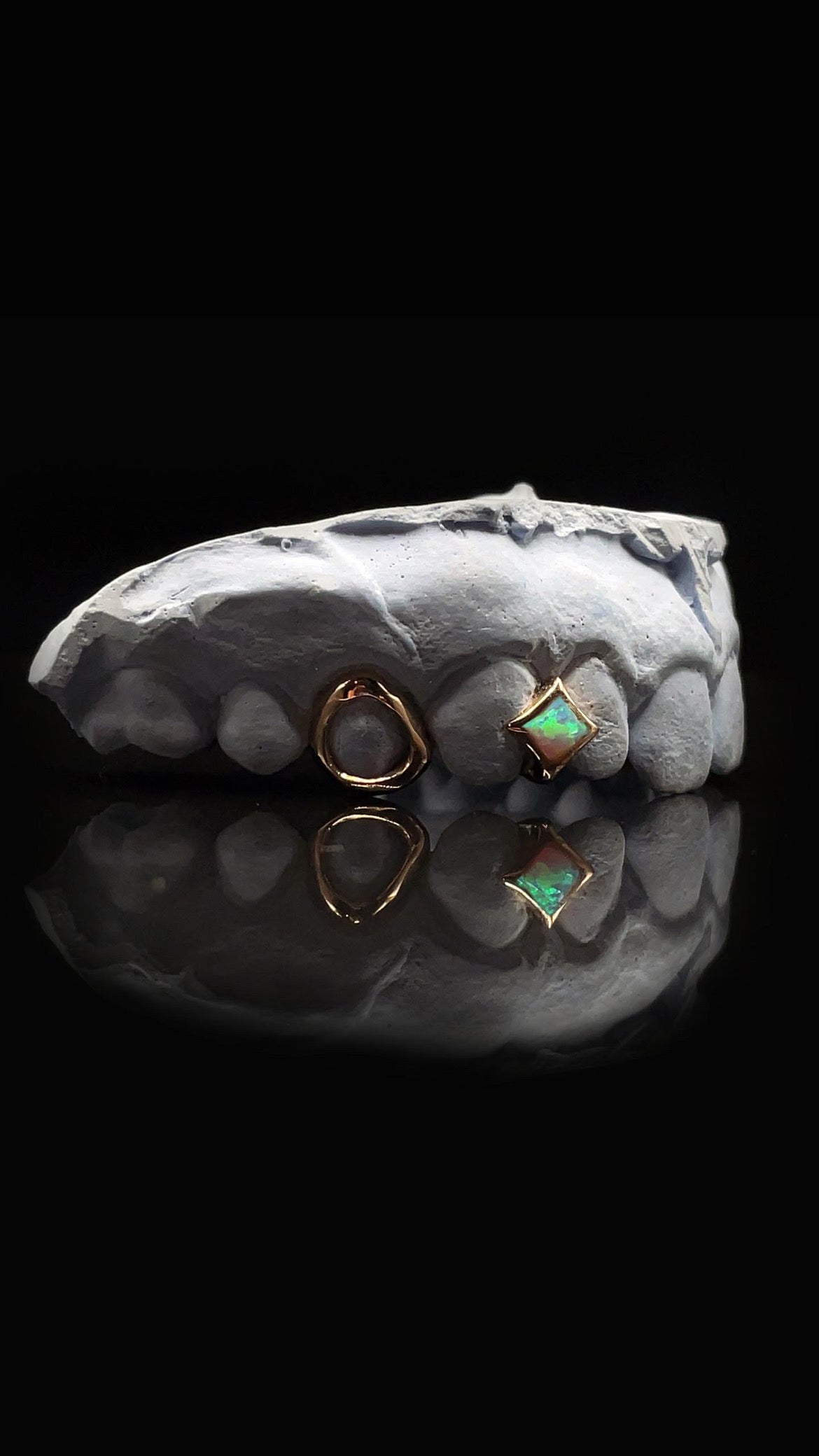 Rose Gold Grillz