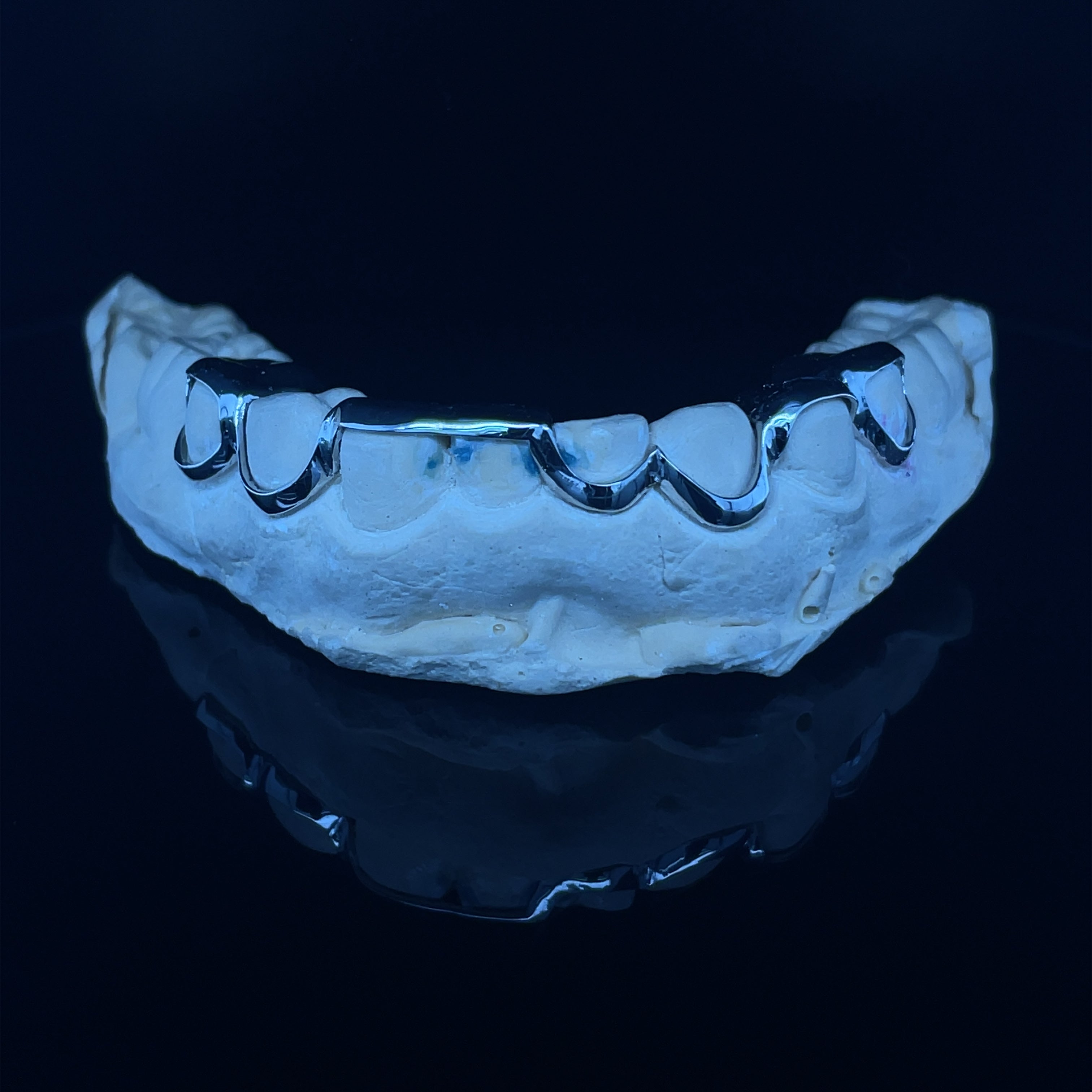 White Gold Grillz