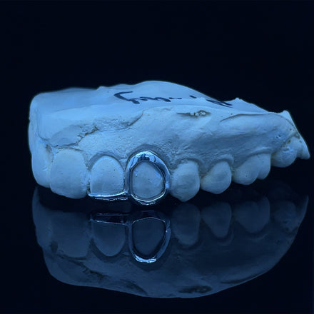 White Gold Grillz